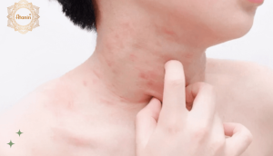 Nổi nốt đỏ trên da và ngứa – Nguyên nhân và khắc phục